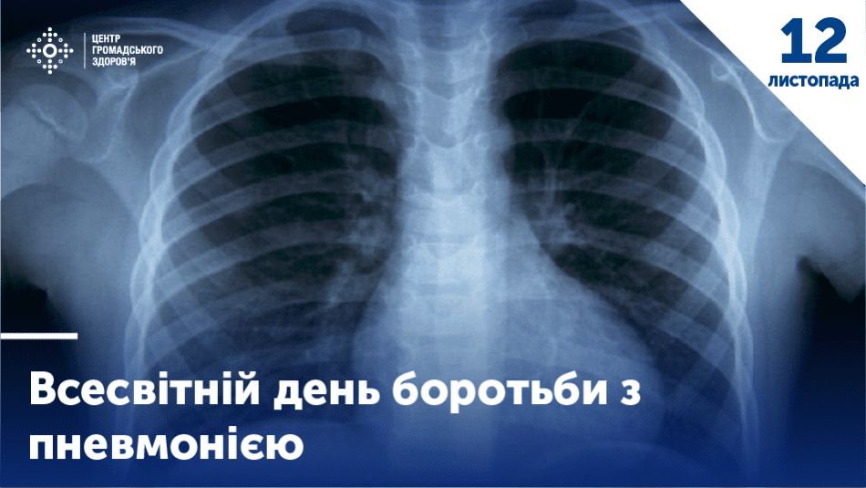 12 листопада - Всесвітній день боротьби із пневмонією детская больница запорожье КНП «Міська дитяча лікарня №5» ЗМР – це єдина у місті Запоріжжі багатопрофільна дитяча лікарня, де сконцентровано всі види надання спеціалізованої медичної допомоги дитячому населенню: стаціонарної, консультативної амбулаторно-поліклінічної та виїзної для інтенсивної терапії новонародженим.