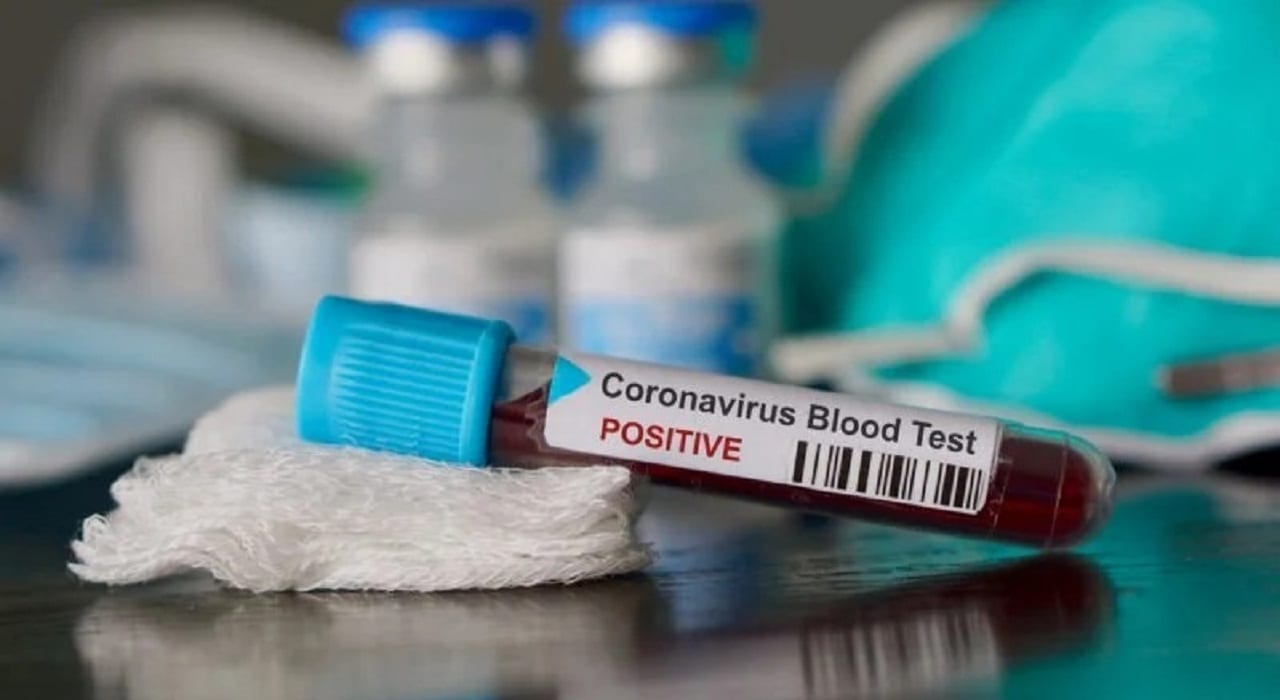 Алгоритм дій за підозри COVID-19 детская больница запорожье КНП «Міська дитяча лікарня №5» ЗМР – це єдина у місті Запоріжжі багатопрофільна дитяча лікарня, де сконцентровано всі види надання спеціалізованої медичної допомоги дитячому населенню: стаціонарної, консультативної амбулаторно-поліклінічної та виїзної для інтенсивної терапії новонародженим.