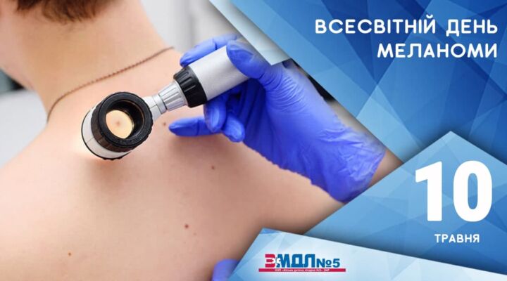Всесвітній день меланоми: групи ризику та як розпізнати пухлину детская больница запорожье КНП «Міська дитяча лікарня №5» ЗМР – це єдина у місті Запоріжжі багатопрофільна дитяча лікарня, де сконцентровано всі види надання спеціалізованої медичної допомоги дитячому населенню: стаціонарної, консультативної амбулаторно-поліклінічної та виїзної для інтенсивної терапії новонародженим.