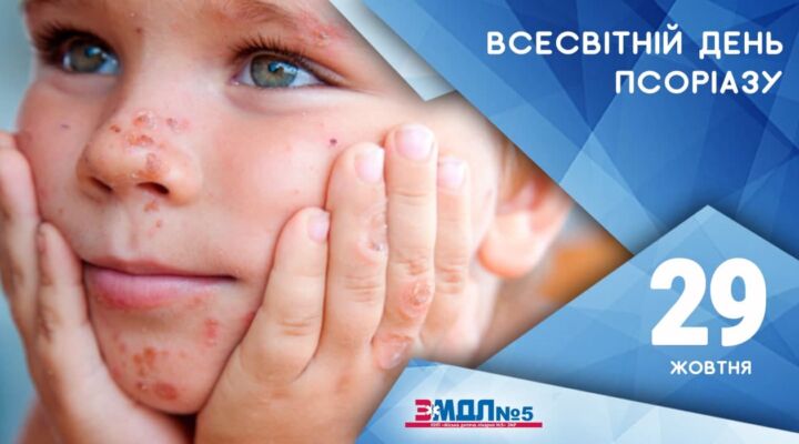 29 жовтня - Всесвітній день псоріазу детская больница запорожье КНП «Міська дитяча лікарня №5» ЗМР – це єдина у місті Запоріжжі багатопрофільна дитяча лікарня, де сконцентровано всі види надання спеціалізованої медичної допомоги дитячому населенню: стаціонарної, консультативної амбулаторно-поліклінічної та виїзної для інтенсивної терапії новонародженим.