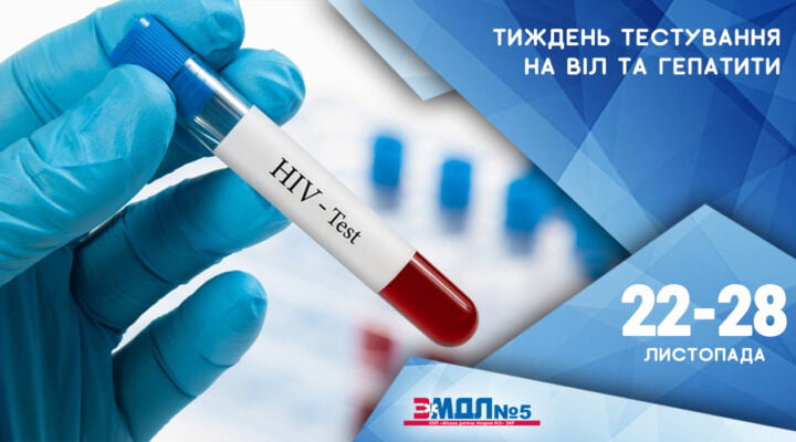 В Україні стартує тиждень тестування на ВІЛ та гепатити детская больница запорожье КНП «Міська дитяча лікарня №5» ЗМР – це єдина у місті Запоріжжі багатопрофільна дитяча лікарня, де сконцентровано всі види надання спеціалізованої медичної допомоги дитячому населенню: стаціонарної, консультативної амбулаторно-поліклінічної та виїзної для інтенсивної терапії новонародженим.