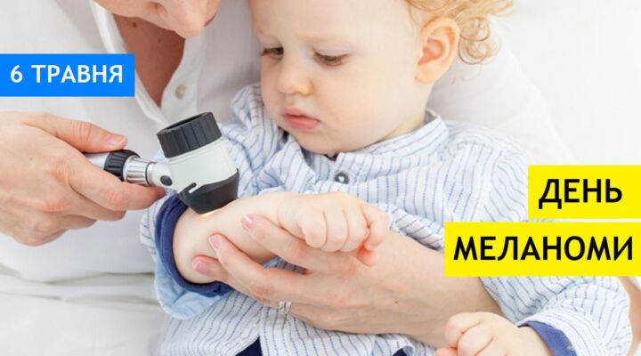 Родимка чи меланома: як розпізнати небезпеку детская больница запорожье КНП «Міська дитяча лікарня №5» ЗМР – це єдина у місті Запоріжжі багатопрофільна дитяча лікарня, де сконцентровано всі види надання спеціалізованої медичної допомоги дитячому населенню: стаціонарної, консультативної амбулаторно-поліклінічної та виїзної для інтенсивної терапії новонародженим.