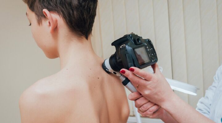 Що потрібно знати про меланому детская больница запорожье КНП «Міська дитяча лікарня №5» ЗМР – це єдина у місті Запоріжжі багатопрофільна дитяча лікарня, де сконцентровано всі види надання спеціалізованої медичної допомоги дитячому населенню: стаціонарної, консультативної амбулаторно-поліклінічної та виїзної для інтенсивної терапії новонародженим.