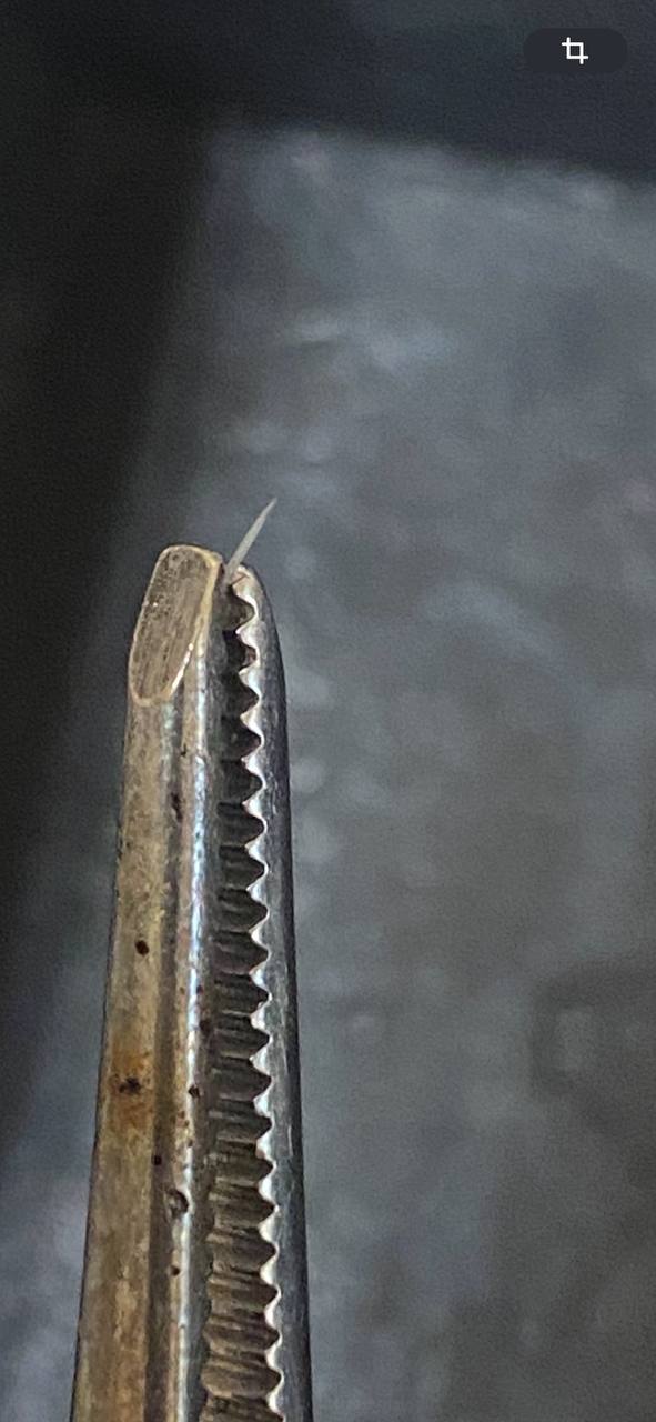 Крихітна проблема, яка може перерости в серйозне запалення детская больница запорожье КНП «Міська дитяча лікарня №5» ЗМР – це єдина у місті Запоріжжі багатопрофільна дитяча лікарня, де сконцентровано всі види надання спеціалізованої медичної допомоги дитячому населенню: стаціонарної, консультативної амбулаторно-поліклінічної та виїзної для інтенсивної терапії новонародженим. Крихітна проблема, яка може перерости в серйозне запалення детская больница запорожье КНП «Міська дитяча лікарня №5» ЗМР – це єдина у місті Запоріжжі багатопрофільна дитяча лікарня, де сконцентровано всі види надання спеціалізованої медичної допомоги дитячому населенню: стаціонарної, консультативної амбулаторно-поліклінічної та виїзної для інтенсивної терапії новонародженим.