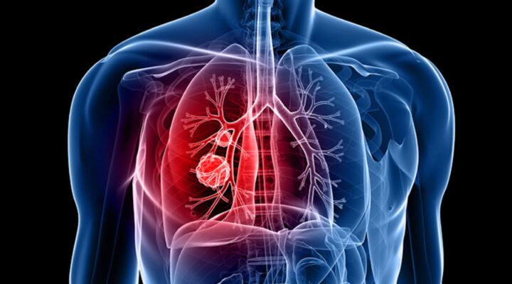 5 травня - Міжнародний день легеневої гіпертензії детская больница запорожье КНП «Міська дитяча лікарня №5» ЗМР – це єдина у місті Запоріжжі багатопрофільна дитяча лікарня, де сконцентровано всі види надання спеціалізованої медичної допомоги дитячому населенню: стаціонарної, консультативної амбулаторно-поліклінічної та виїзної для інтенсивної терапії новонародженим.