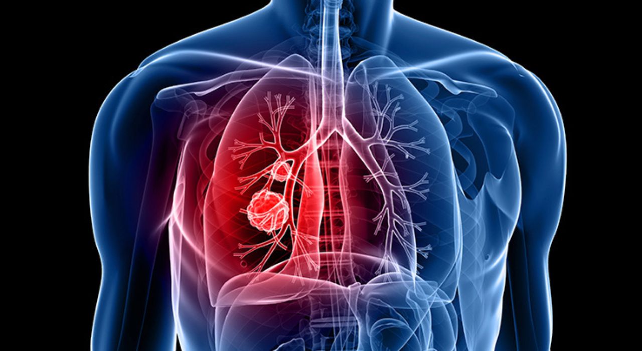5 травня - Міжнародний день легеневої гіпертензії детская больница запорожье КНП «Міська дитяча лікарня №5» ЗМР – це єдина у місті Запоріжжі багатопрофільна дитяча лікарня, де сконцентровано всі види надання спеціалізованої медичної допомоги дитячому населенню: стаціонарної, консультативної амбулаторно-поліклінічної та виїзної для інтенсивної терапії новонародженим. 5 травня - Міжнародний день легеневої гіпертензії детская больница запорожье КНП «Міська дитяча лікарня №5» ЗМР – це єдина у місті Запоріжжі багатопрофільна дитяча лікарня, де сконцентровано всі види надання спеціалізованої медичної допомоги дитячому населенню: стаціонарної, консультативної амбулаторно-поліклінічної та виїзної для інтенсивної терапії новонародженим.