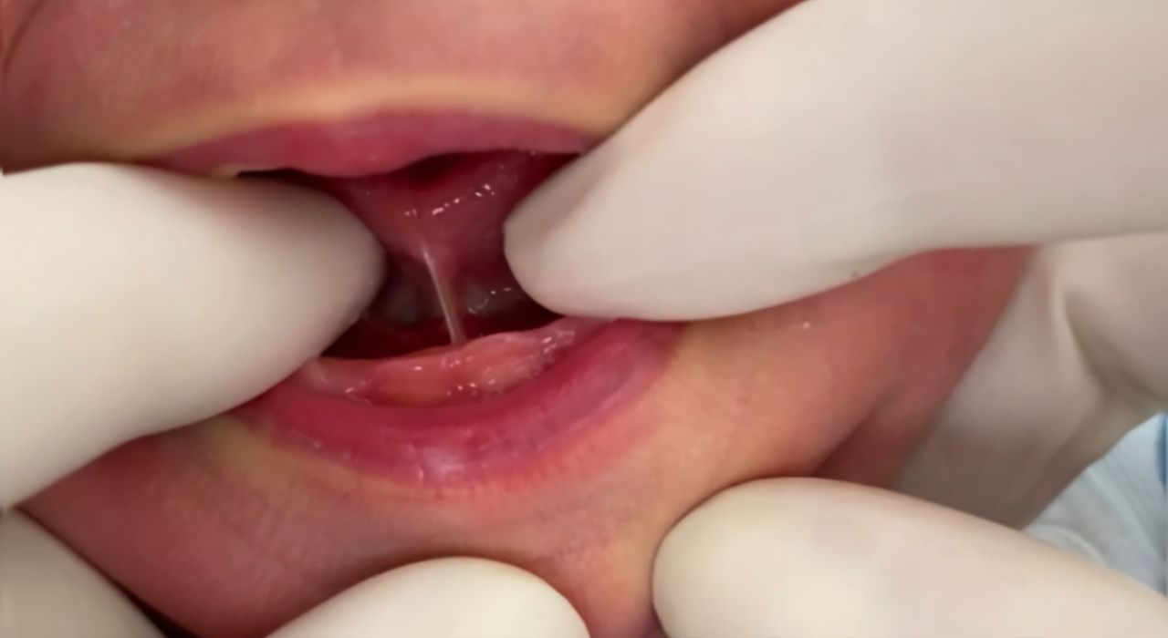 Анкілоглосія:основні моменти детская больница запорожье КНП «Міська дитяча лікарня №5» ЗМР – це єдина у місті Запоріжжі багатопрофільна дитяча лікарня, де сконцентровано всі види надання спеціалізованої медичної допомоги дитячому населенню: стаціонарної, консультативної амбулаторно-поліклінічної та виїзної для інтенсивної терапії новонародженим. Анкілоглосія:основні моменти детская больница запорожье КНП «Міська дитяча лікарня №5» ЗМР – це єдина у місті Запоріжжі багатопрофільна дитяча лікарня, де сконцентровано всі види надання спеціалізованої медичної допомоги дитячому населенню: стаціонарної, консультативної амбулаторно-поліклінічної та виїзної для інтенсивної терапії новонародженим.