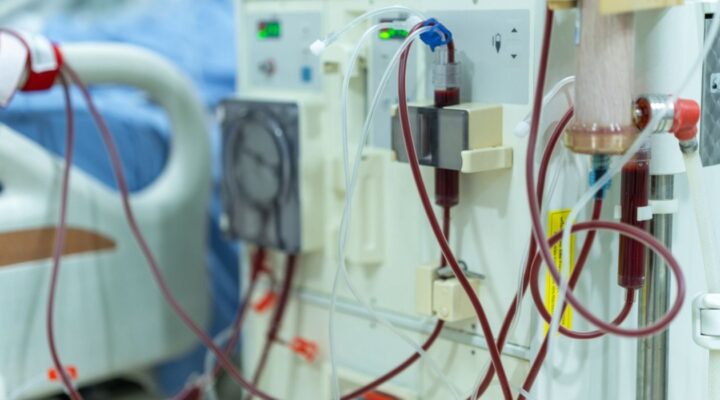 Гемодіаліз: процедура, яка продовжує життя детская больница запорожье КНП «Міська дитяча лікарня №5» ЗМР – це єдина у місті Запоріжжі багатопрофільна дитяча лікарня, де сконцентровано всі види надання спеціалізованої медичної допомоги дитячому населенню: стаціонарної, консультативної амбулаторно-поліклінічної та виїзної для інтенсивної терапії новонародженим.