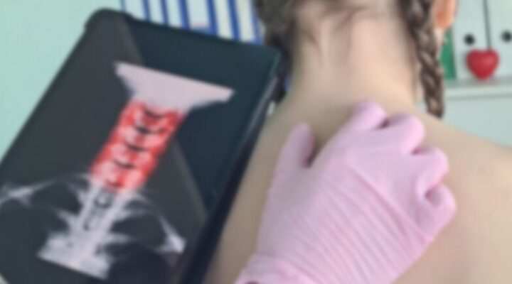 Клінічний випадок: аномалія Кімерлі детская больница запорожье КНП «Міська дитяча лікарня №5» ЗМР – це єдина у місті Запоріжжі багатопрофільна дитяча лікарня, де сконцентровано всі види надання спеціалізованої медичної допомоги дитячому населенню: стаціонарної, консультативної амбулаторно-поліклінічної та виїзної для інтенсивної терапії новонародженим.