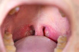 Небезпечно: ентеровірусні інфекції! детская больница запорожье КНП «Міська дитяча лікарня №5» ЗМР – це єдина у місті Запоріжжі багатопрофільна дитяча лікарня, де сконцентровано всі види надання спеціалізованої медичної допомоги дитячому населенню: стаціонарної, консультативної амбулаторно-поліклінічної та виїзної для інтенсивної терапії новонародженим.