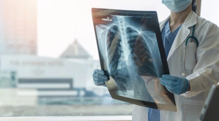 Популярні міфи про туберкульоз детская больница запорожье КНП «Міська дитяча лікарня №5» ЗМР – це єдина у місті Запоріжжі багатопрофільна дитяча лікарня, де сконцентровано всі види надання спеціалізованої медичної допомоги дитячому населенню: стаціонарної, консультативної амбулаторно-поліклінічної та виїзної для інтенсивної терапії новонародженим.