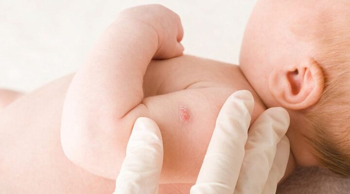 Вакцина БЦЖ: що це та для чого використовується? детская больница запорожье КНП «Міська дитяча лікарня №5» ЗМР – це єдина у місті Запоріжжі багатопрофільна дитяча лікарня, де сконцентровано всі види надання спеціалізованої медичної допомоги дитячому населенню: стаціонарної, консультативної амбулаторно-поліклінічної та виїзної для інтенсивної терапії новонародженим.