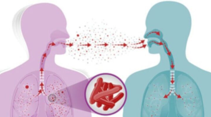 Форми туберкульозу та групи ризику детская больница запорожье КНП «Міська дитяча лікарня №5» ЗМР – це єдина у місті Запоріжжі багатопрофільна дитяча лікарня, де сконцентровано всі види надання спеціалізованої медичної допомоги дитячому населенню: стаціонарної, консультативної амбулаторно-поліклінічної та виїзної для інтенсивної терапії новонародженим.